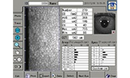 角膜内皮細胞解析装置